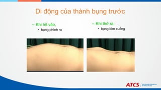 – Khi hít vào,
• bụng phình ra
– Khi thở ra,
• bụng lõm xuống
Di động của thành bụng trước
 