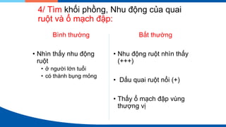4/ Tìm khối phồng, Nhu động của quai
ruột và ổ mạch đập:
Bình thường
• Nhìn thấy nhu động
ruột
• ở người lớn tuổi
• có thành bụng mỏng
Bất thường
• Nhu động ruột nhìn thấy
(+++)
• Dấu quai ruột nổi (+)
• Thấy ổ mạch đập vùng
thượng vị
 