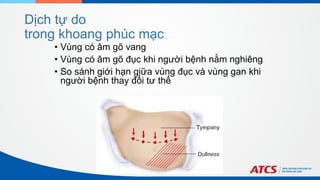 Dịch tự do
trong khoang phúc mạc
• Vùng có âm gõ vang
• Vùng có âm gõ đục khi người bệnh nằm nghiêng
• So sánh giới hạn giữa vùng đục và vùng gan khi
người bệnh thay đổi tư thế
 