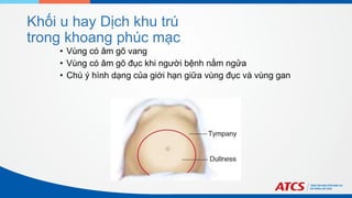 Khối u hay Dịch khu trú
trong khoang phúc mạc
• Vùng có âm gõ vang
• Vùng có âm gõ đục khi người bệnh nằm ngửa
• Chú ý hình dạng của giới hạn giữa vùng đục và vùng gan
 