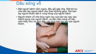 Dấu sóng vỗ
• Đặt người bệnh nằm ngửa, đầu gối gập nhẹ. Đặt bờ trụ
của bàn tay người bệnh dọc theo đường giữa. Hai bàn
tay người khám đặt ở vùng hông của người bệnh.
• Người khám vỗ nhẹ lòng ngón tay của bàn tay này vào
thành bụng của người bệnh, có dấu hiệu sóng vỗ nếu
cảm thấy như có dịch đập vào lòng bàn tay kia của người
khám.
 