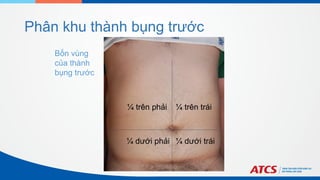 Phân khu thành bụng trước
¼ trên phải
Bốn vùng
của thành
bụng trước
¼ trên trái
¼ dưới trái
¼ dưới phải
 
