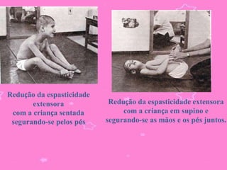 Redução da espasticidade
       extensora            Redução da espasticidade extensora
 com a criança sentada          com a criança em supino e
 segurando-se pelos pés.   segurando-se as mãos e os pés juntos.
 