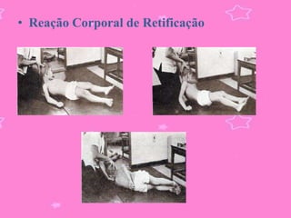 • Reação Corporal de Retificação
 