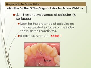 Slide_Briefing Calibration Gingival Index (GIS) 2025.pptx