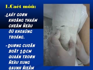 1.Caét môû:
-Laáy

goøn
khoâng thaám
cheâm ñeàu
ôû khoaûng
troáng.

-Duøng cuoän
boät 10cm
quaán troøn
ñeàu xung
qaunh ñieåm

 