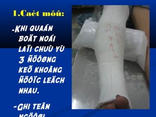 1.Caét môû:
-Khi

quaán
boät noái
laïi chuù yù
3 ñöôøng
keõ khoâng
ñöôïc leäch
nhau.

-Ghi teân

 