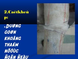 2.Caétkheù
p:
-Duøng

goøn
khoâng
thaám
nöôùc

 