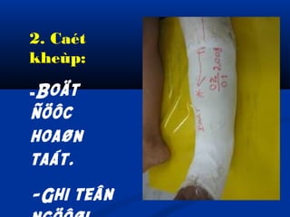 2. Caét
kheùp:
-Boät

ñöôc
hoaøn
taát.
-Ghi teân

 