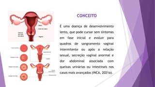 CONCEITO
É uma doença de desenvolvimento
lento, que pode cursar sem sintomas
em fase inicial e evoluir para
quadros de sangramento vaginal
intermitente ou após a relação
sexual, secreção vaginal anormal e
dor abdominal associada com
queixas urinárias ou intestinais nos
casos mais avançados (INCA, 2021a).
 