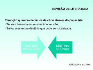 REVISÃO DE LITERATURA



Remoção química-mecânica da cárie através do papacárie
• Técnica baseada em mínima intervenção;
• Salvar a estrutura dentária que pode ser cicatrizada.




                                             ERICSON et al., 1999.
 