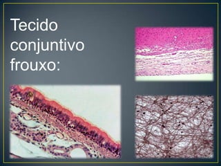 Tecido
conjuntivo
frouxo:
 