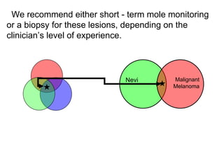 We recommend either short - term mole monitoring
or a biopsy for these lesions, depending on the
clinician’s level of experience.




                            Nevi        Malignant
                                        Melanoma
 