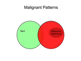 Malignant Patterns




Nevi             Malignant
                 Melanoma
 