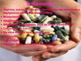 Tratamento
 Aspirina, outras drogas anti-inflamatórias não esteróides e
analgésicos comuns (acetaminofeno);
 Mastectomia;
 Alendronato;
 Bifosfanato e Analgésico, além do Ácido Zoledrônico
 Calcitonina do Salmão;
 Na vulva excisão local; vulvectomia;
 Etidronato;
 Pamidronato
 Algumas vezes, a cirurgia é necessária;
 