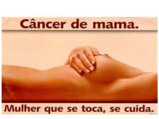  Câncer de mama