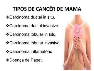 TIPOS DE CANCÊR DE MAMA
Carcinoma ductal in situ.
Carcinoma ductal invasivo.
Carcinoma lobular in situ.
Carcinoma lobular invasivo
Carcinoma inflamatório.
Doença de Paget.
 