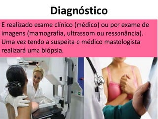 Diagnóstico
E realizado exame clínico (médico) ou por exame de
imagens (mamografia, ultrassom ou ressonância).
Uma vez tendo a suspeita o médico mastologista
realizará uma biópsia.
 
