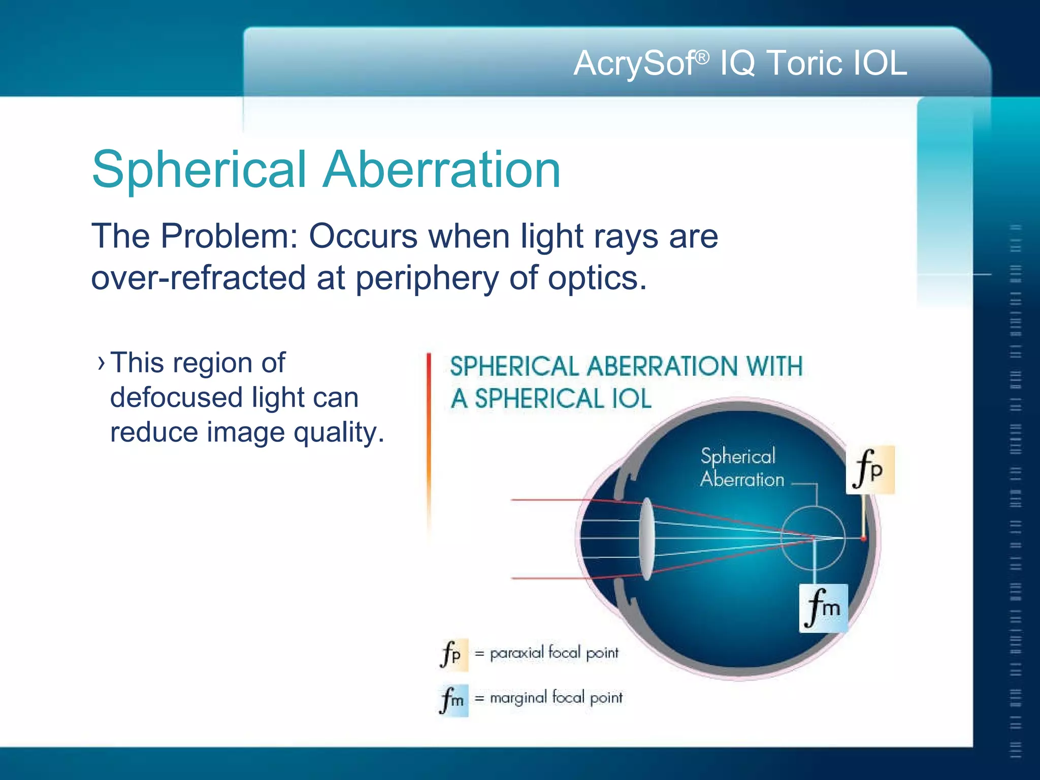 This region of  defocused light can  reduce image quality.  Spherical Aberration  The Problem: Occurs when light rays are  over-refracted at periphery of optics. 