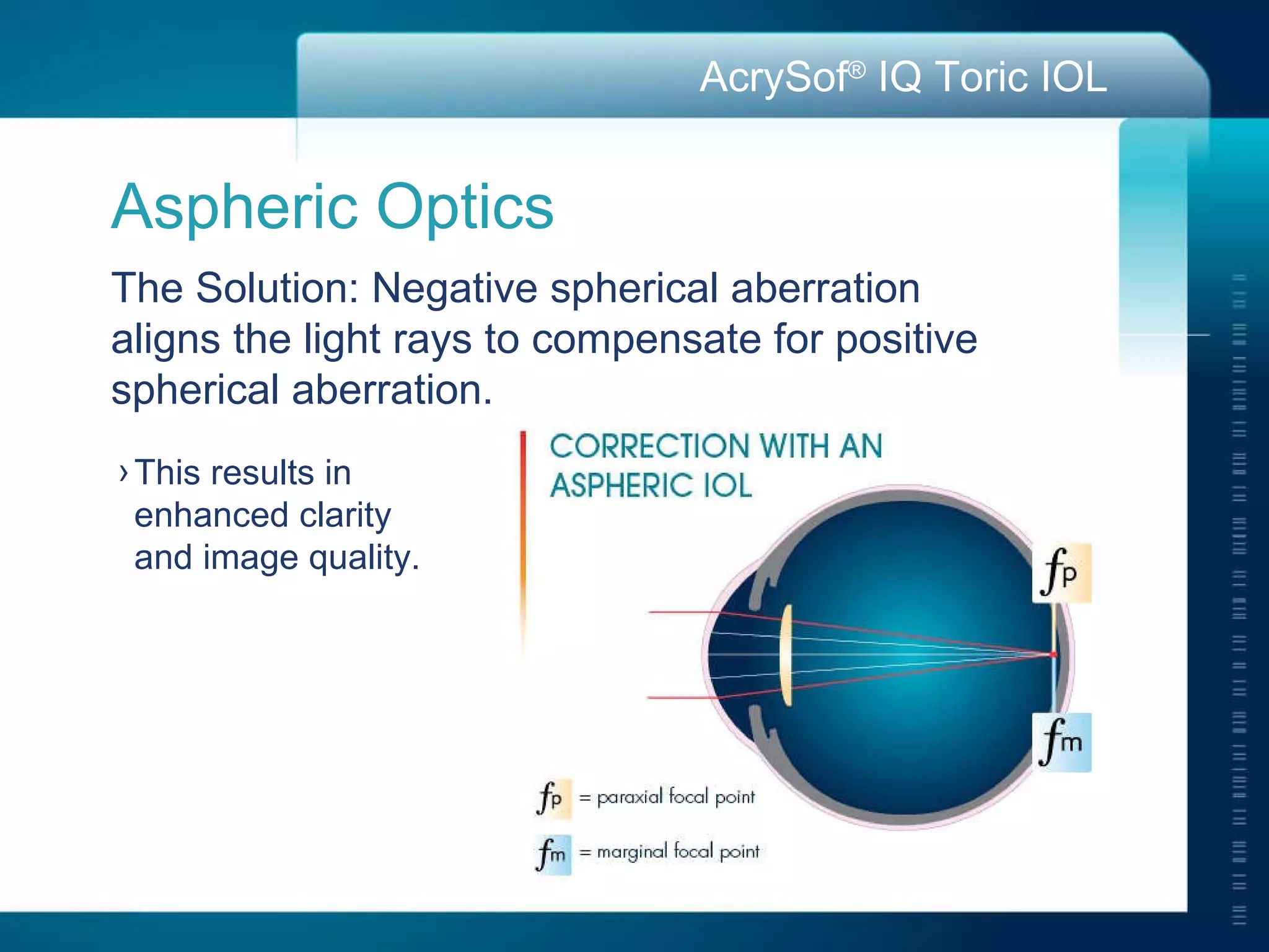 This results in  enhanced clarity  and image quality.  Aspheric Optics  The Solution: Negative spherical aberration  aligns the light rays to compensate for positive  spherical aberration. 