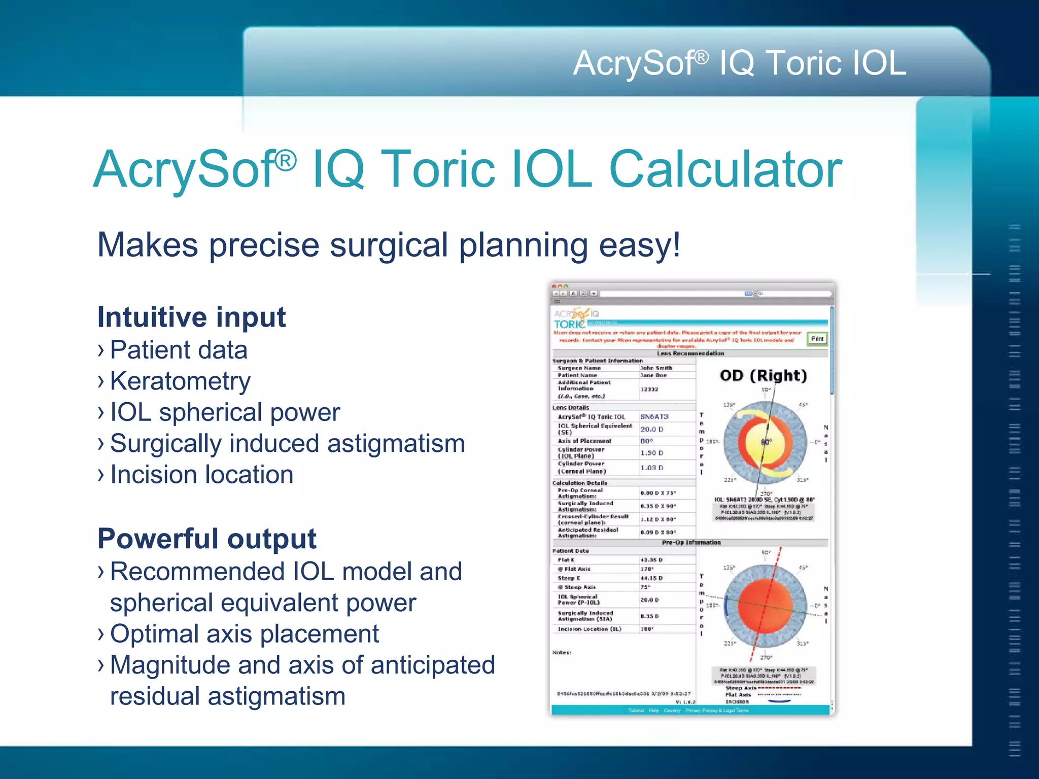AcrySof ®  IQ Toric IOL Calculator Makes precise surgical planning easy! Intuitive input Patient data Keratometry IOL spherical power Surgically induced astigmatism Incision location Powerful output Recommended IOL model and spherical equivalent power Optimal axis placement Magnitude and axis of anticipated residual astigmatism 