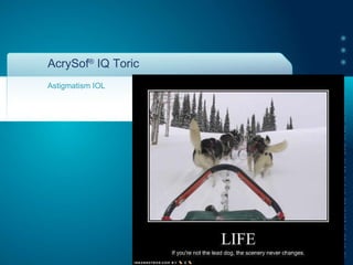 AcrySof ®  IQ Toric Astigmatism IOL 