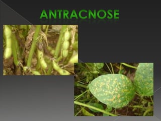 Mosaico amarelo (VMAF)O vírus do mosaico amarelo do feijoeiro é disseminado na lavoura  por afídeos, não sendo transmitido por sementes, o que constitui uma das principais diferenças entre o vírus do mosaico amarelo e o vírus do mosaico dourado do feijoeiro. Os sintomas característicos são áreas cloróticas irregulares intercaladas com áreas verdes normais da folha. No caso de infecção precoce, as plantas tornam-se enfezadas, as folhas adquirem mosaico brilhante, tornando-se quebradiças, e os folíolos tornam-se enrolados. Pode ocorrer superbrotamento e retardamento da maturação das plantas.Controle: uso de cultivares resistentes e aplicações de inseticidas para o controle do inseto vetor do vírus.FEIJOEIRO-DOENÇAS por vírus