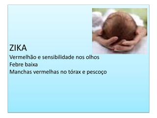 ZIKA
Vermelhão e sensibilidade nos olhos
Febre baixa
Manchas vermelhas no tórax e pescoço
 
