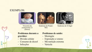 EXEMPLOS:

Trissomia do
cromossomo 21
(Down)

Problemas durante a
gravidez:
- Divisão celular
- Consumo de álcool
- Infecções

Síndrome de PraderWili

Síndrome do X frágil

Problemas de saúde:
- Meningite
- Exposição a veneno
- Má nutrição extrema
- Varicela

 