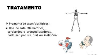 ➢ Programa de exercícios físicos;
➢ Uso de anti-inflamatórios,
corticoides e broncodilatadores,
pode ser por via oral ou inalatória;
TRATAMENTO
Fonte: Google Imagens
 
