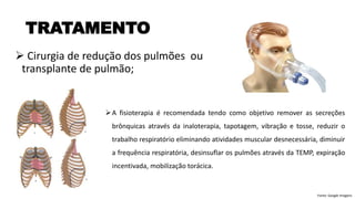 ➢ Cirurgia de redução dos pulmões ou
transplante de pulmão;
TRATAMENTO
➢A fisioterapia é recomendada tendo como objetivo remover as secreções
brônquicas através da inaloterapia, tapotagem, vibração e tosse, reduzir o
trabalho respiratório eliminando atividades muscular desnecessária, diminuir
a frequência respiratória, desinsuflar os pulmões através da TEMP, expiração
incentivada, mobilização torácica.
Fonte: Google Imagens
 
