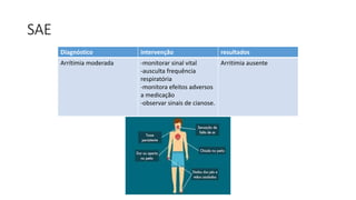 SAE
Diagnóstico intervenção resultados
Arrítimia moderada -monitorar sinal vital
-ausculta frequência
respiratória
-monitora efeitos adversos
a medicação
-observar sinais de cianose.
Arritimia ausente
 