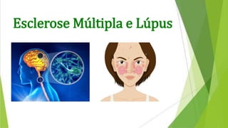 Esclerose Múltipla e Lúpus
 