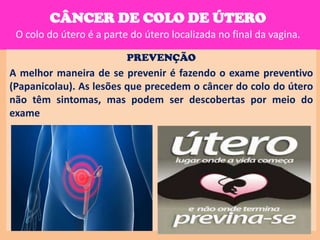 CÂNCER DE COLO DE ÚTERO
 O colo do útero é a parte do útero localizada no final da vagina.

                          PREVENÇÃO
A melhor maneira de se prevenir é fazendo o exame preventivo
(Papanicolau). As lesões que precedem o câncer do colo do útero
não têm sintomas, mas podem ser descobertas por meio do
exame
 