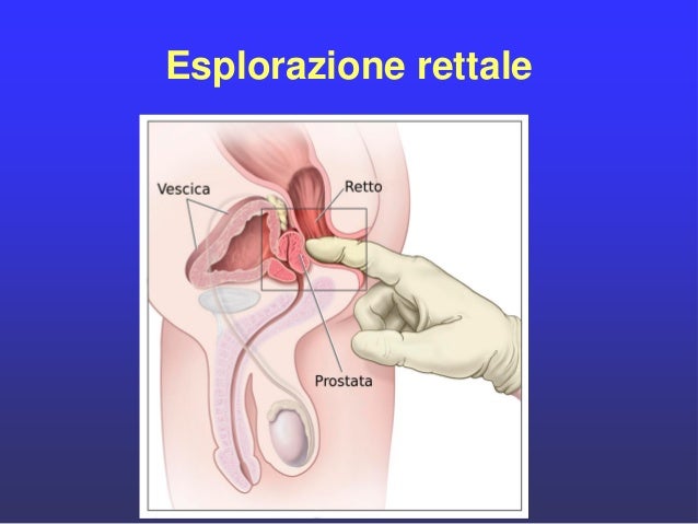 Quanti la temperatura dopo che loperazione può tenere paraproktit