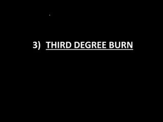 .
3) THIRD DEGREE BURN
 