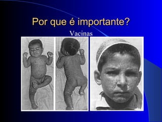 Por que é importante?Por que é importante?
Vacinas
 