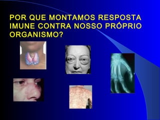 POR QUE MONTAMOS RESPOSTA
IMUNE CONTRA NOSSO PRÓPRIO
ORGANISMO?
 