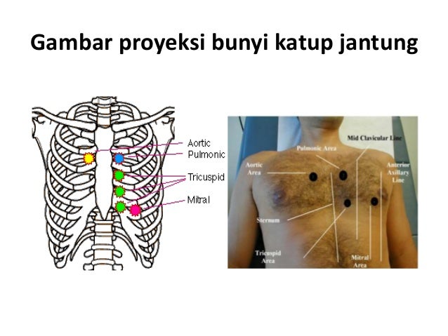 Slide Jantung