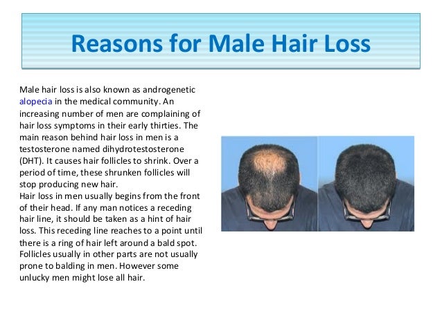 Argan Life Hair Loss Treatment