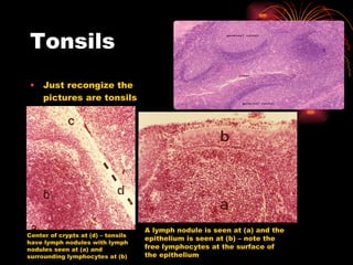 Tonsils Just recongize the pictures are tonsils Center of crypts at (d) – tonsils have lymph nodules with lymph nodules seen at (a) and surrounding lymphocytes at (b) A lymph nodule is seen at (a) and the epithelium is seen at (b) – note the free lymphocytes at the surface of the epithelium 