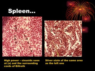 Spleen… High power – sinuoids seen at (a) and the surrounding cords of Billroth Silver stain of the same area as the left one 