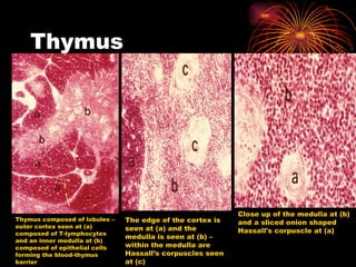 Thymus Thymus composed of lobules – outer cortex seen at (a) composed of T-lymphocytes and an inner medulla at (b) composed of epithelial cells forming the blood-thymus barrier The edge of the cortex is seen at (a) and the medulla is seen at (b) – within the medulla are Hassall’s corpuscles seen at (c) Close up of the medulla at (b) and a sliced onion shaped Hassall's corpuscle at (a) 
