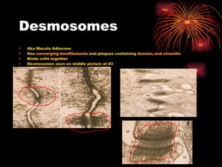 Desmosomes Aka Macula Adherans Has converging tonofilaments and plaques containing desmin, and vimentin Binds cells together Desmosomes seen on middle picture at #3 