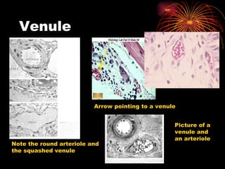 Venule Note the round arteriole and the squashed venule Arrow pointing to a venule Picture of a venule and an arteriole 