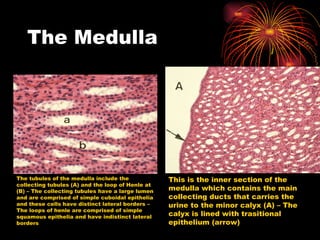 The Medulla The tubules of the medulla include the collecting tubules (A) and the loop of Henle at (B) – The collecting tubules have a large lumen and are comprised of simple cuboidal epithelia and these cells have distinct lateral borders – The loops of henle are comprised of simple squamous epithelia and have indistinct lateral borders This is the inner section of the medulla which contains the main collecting ducts that carries the urine to the minor calyx (A) – The calyx is lined with trasitional epithelium (arrow) 