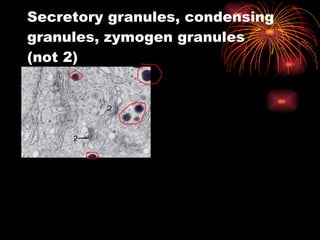 Secretory granules, condensing granules, zymogen granules (not 2) 
