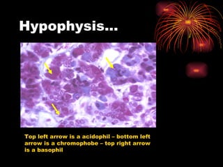 Hypophysis… Top left arrow is a acidophil – bottom left arrow is a chromophobe – top right arrow is a basophil 