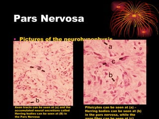 Pars Nervosa Pictures of the neurohypophysis  Axon tracts can be seen at (a) and the accumulated neural secretions called Herring bodies can be seen at (B) in the Pars Nervosa Pituicytes can be seen at (a) – Herring bodies can be seen at (b) in the pars nervosa, while the axon fiber can be seen at (c) 