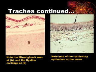 Trachea continued… Note the Mixed glands seen at (A), and the Hyaline cartilage at (B) Note here of the respiratory epithelium at the arrow 